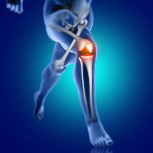 partial knee replacement - knee bone image