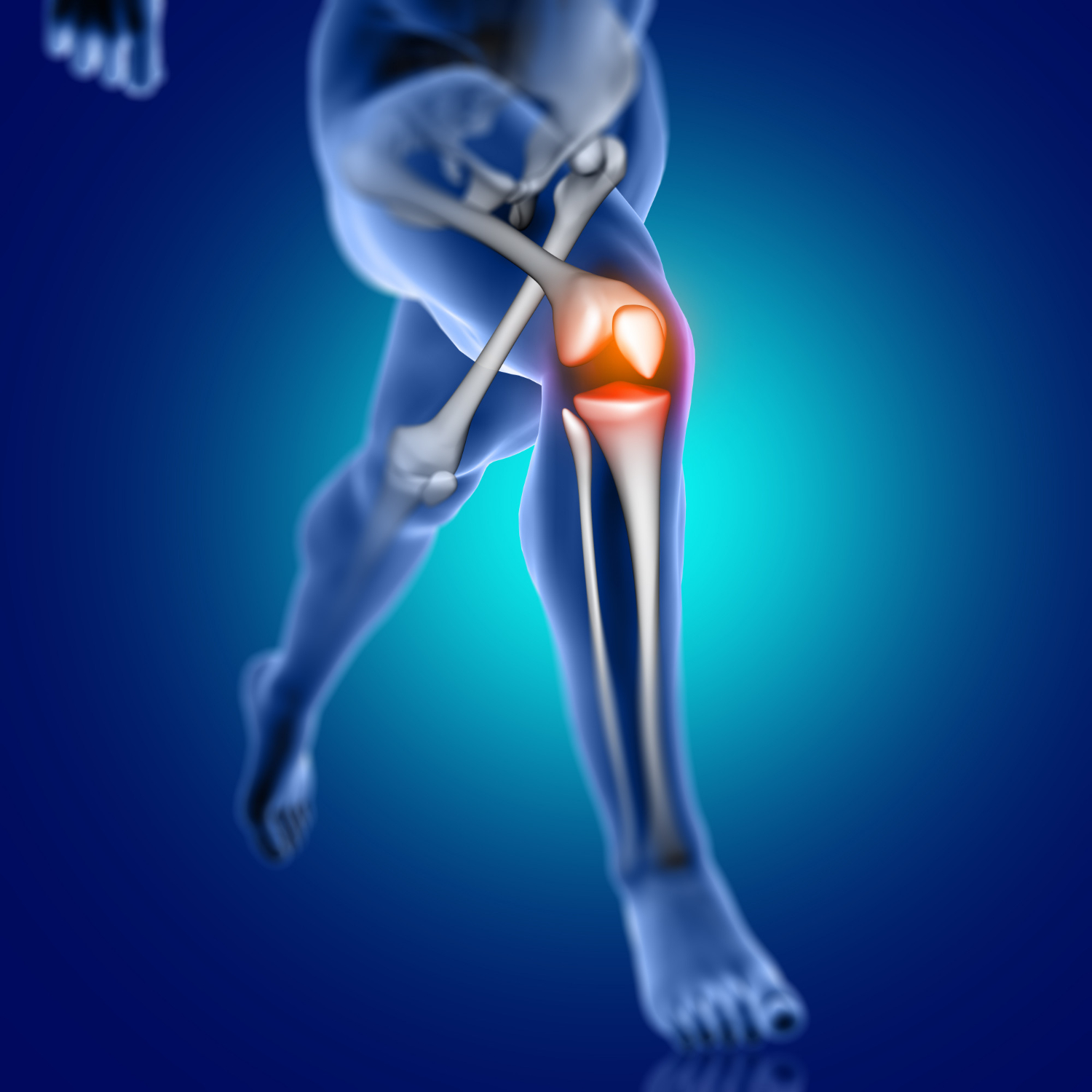 Everything You Need to Know About Partial Knee Replacement