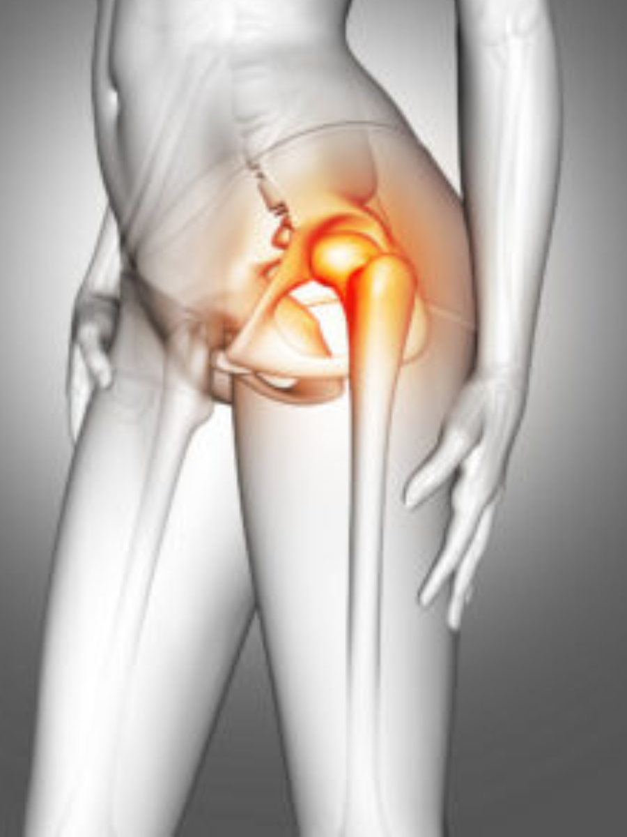 Are You Suffering From Hip Pain? 6 big Hip Pain Causes One Must Know!