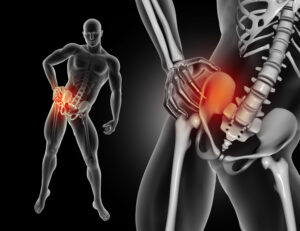 Hip Pain in cold- hip pain