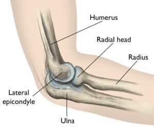 Sports Injuries - tennis elbow