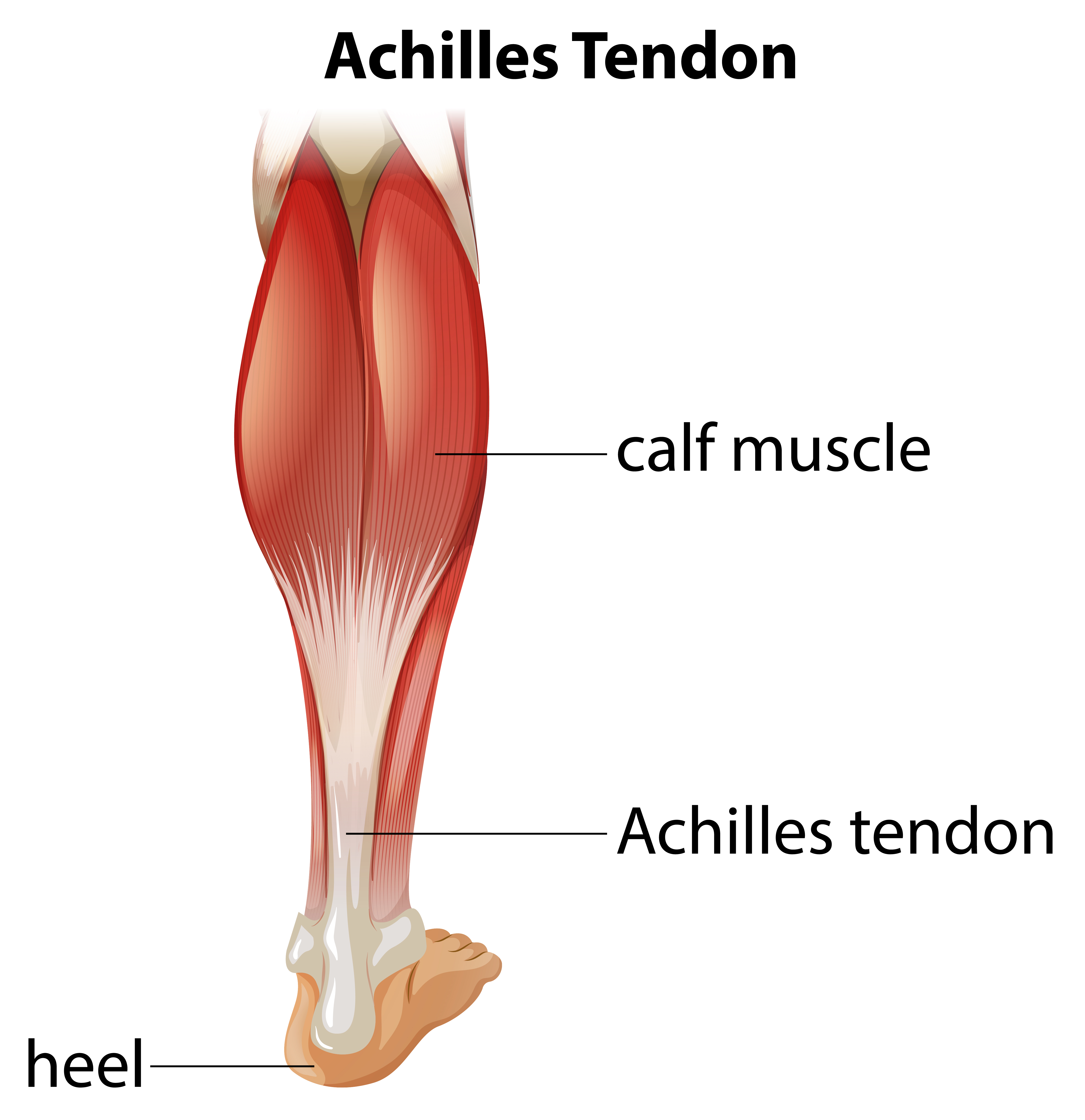 Achilles Tendon