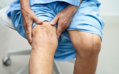 Knee Replacement Surgery - recovery