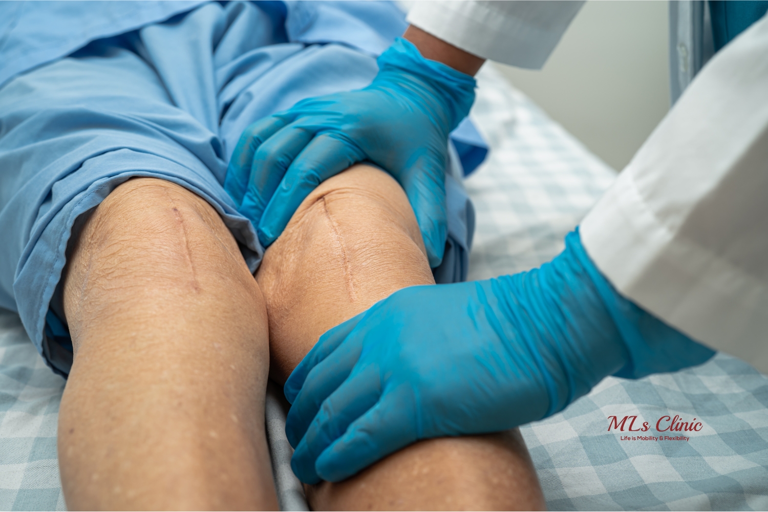 The Benefits and Risks of Bilateral Total Knee Replacement: What You Need to Know