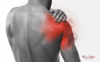 Myths about Frozen Shoulder