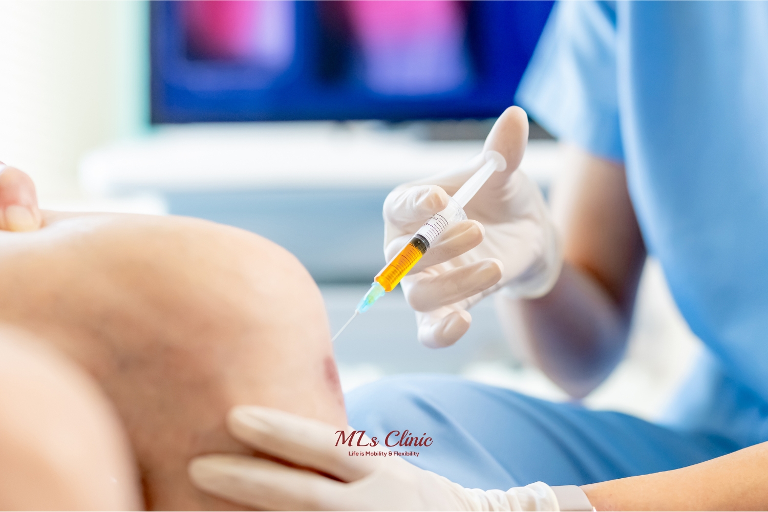 From Cortisone to PRP Therapy: Exploring Joint Injections for Pain Relief