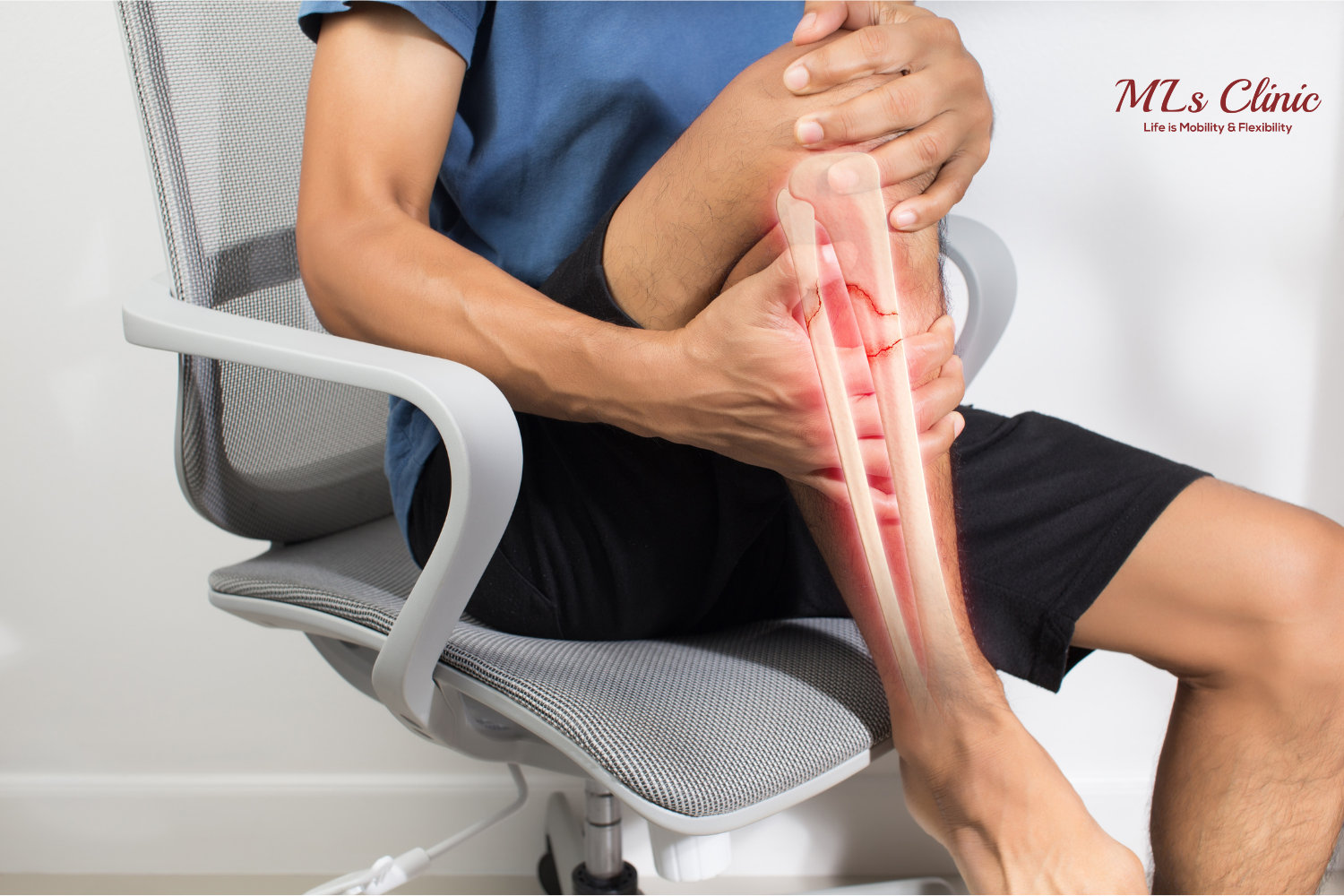 Say Goodbye to Shin Splints with Dr. Preetesh Choudhary