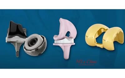 Knee Implants